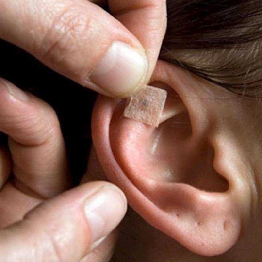 Auriculoterapia - Thaizen